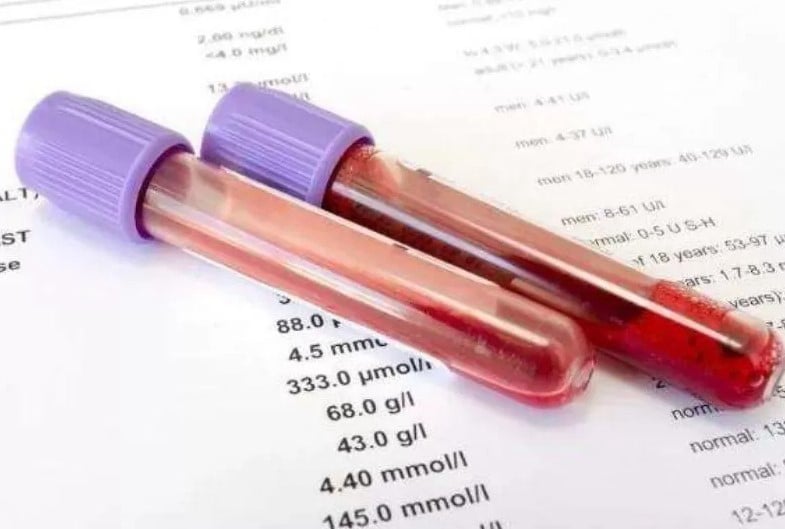 Εξετάσεις Αίματος και Βιοχημικά Τεστ